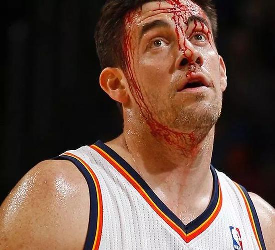 包含雷霆爆冷勇士，艾顿高光表现的词条